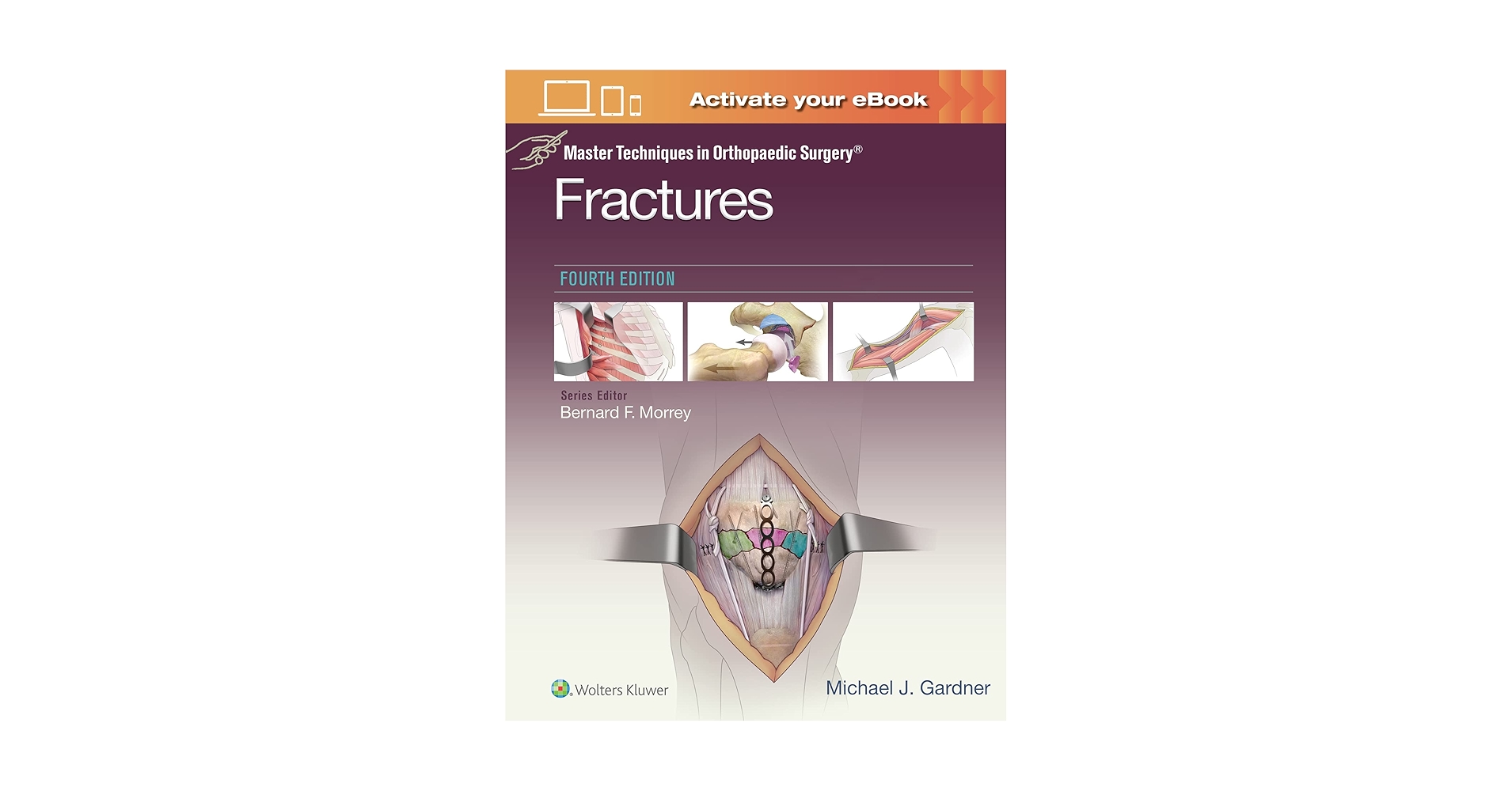 Fractures 第四版 Michael J. Gardner Master Techniques in Orthopaedic Surgery: Fractures